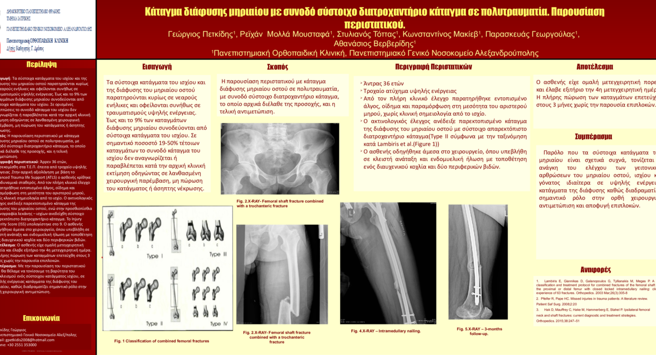 COMBINED FEMORAL FRACTURE