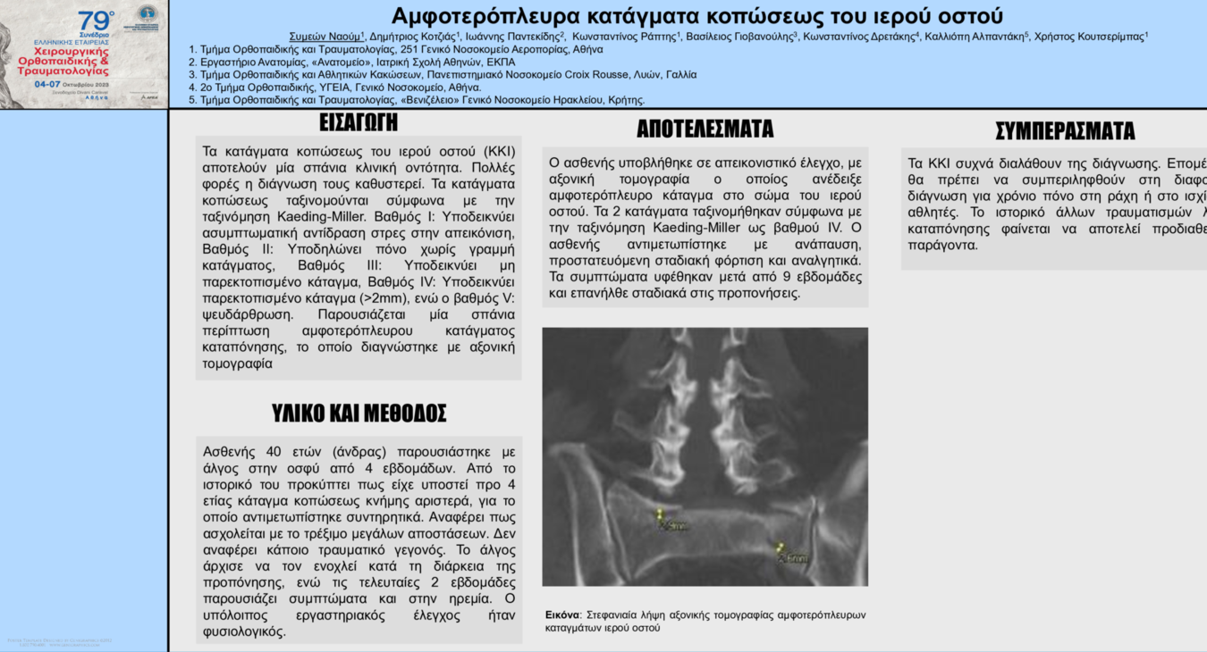 Αμφοτερόπλευρα κατάγματα κοπώσεως του ιερού οστού