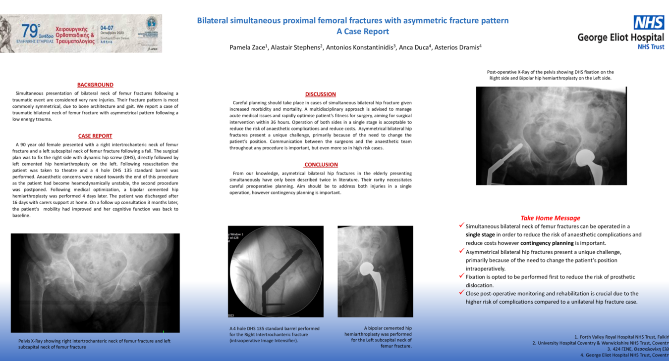 Bilateral simultaneous proximal femoral fractures with asymmetric fracture pattern: A case report