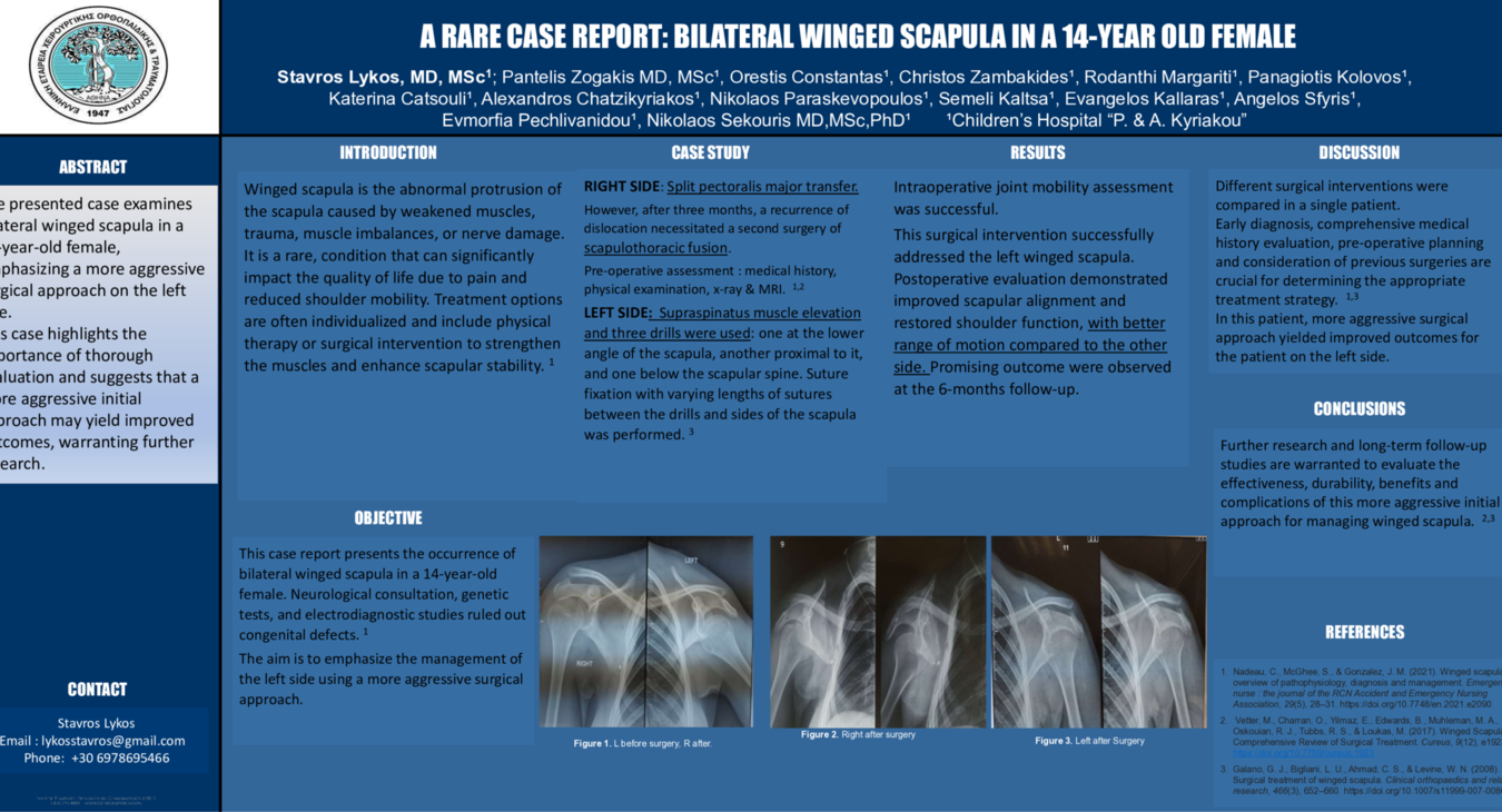 RARE CASE REPORT:BILATERAL WINGED SCAPULA