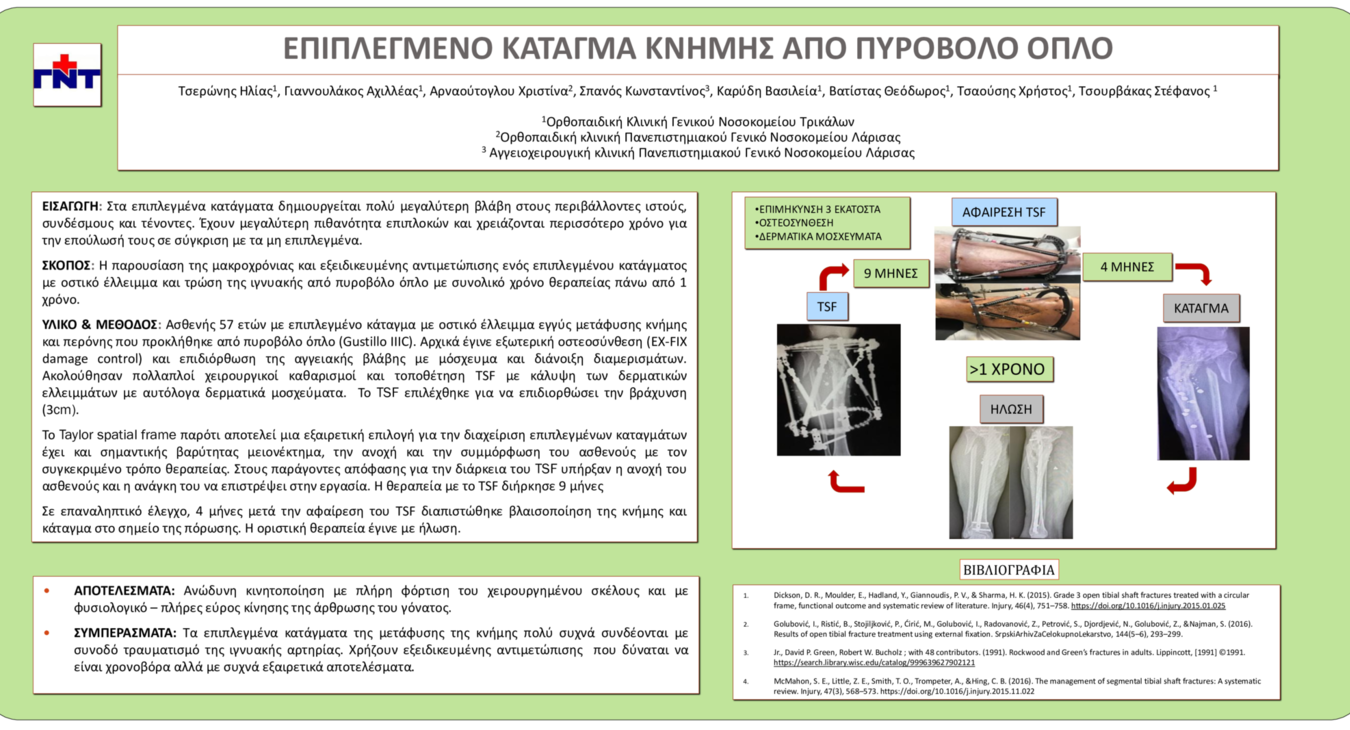 ΚΑΤΑΓΜΑ ΚΝΗΜΗΣ
