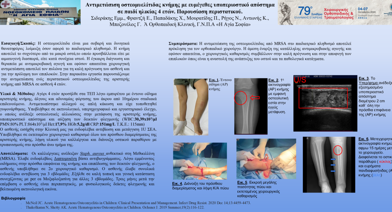 Αντιμετώπιση οστεομυελίτιδας κνήμης με ευμέγεθες υποπεριοστικό απόστημασε παιδί ηλικίας 4 ετών. Παρουσίαση περιστατικού.