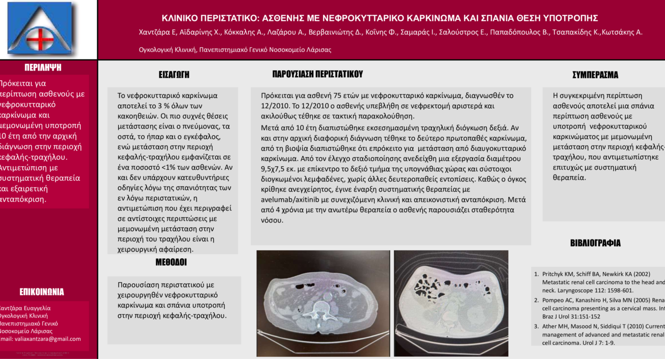 ΚΛΙΝΙΚΟ ΠΕΡΙΣΤΑΤΙΚΟ: ΑΣΘΕΝΗΣ ΜΕ ΝΕΦΡΟΚΥΤΤΑΡΙΚΟ ΚΑΡΚΙΝΩΜΑ ΚΑΙ ΣΠΑΝΙΑ ΘΕΣΗ ΥΠΟΤΡΟΠΗΣ