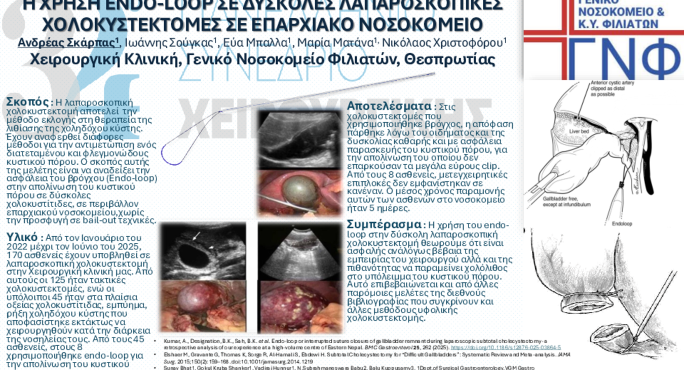 Η ΧΡΗΣΗ ENDO-LOOP ΣΕ ΔΥΣΚΟΛΕΣ ΛΑΠΑΡΟΣΚΟΠΙΚΕΣ ΧΟΛΟΚΥΣΤΕΚΤΟΜΕΣ ΣΕ ΕΠΑΡΧΙΑΚΟ ΝΟΣΟΚΟΜΕΙΟ