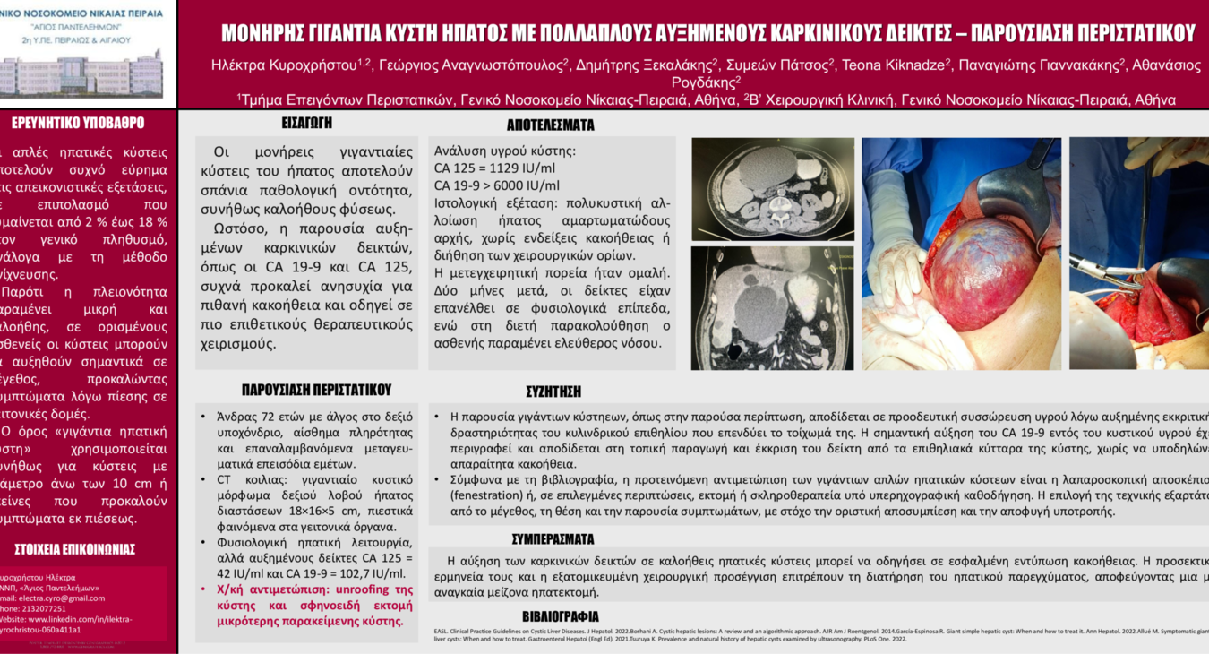 Μονήτης γιγάντια ηπατική κύστη - Παρουσίαση περιστατικού