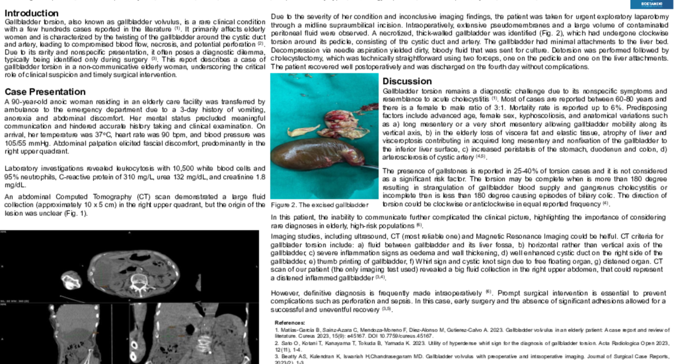 GALLBLADDER TORSION , A CASE REPORT