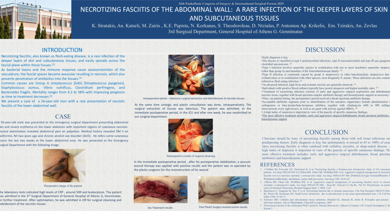 Poster Necrotozing Fasciitis of Abdominal Wall