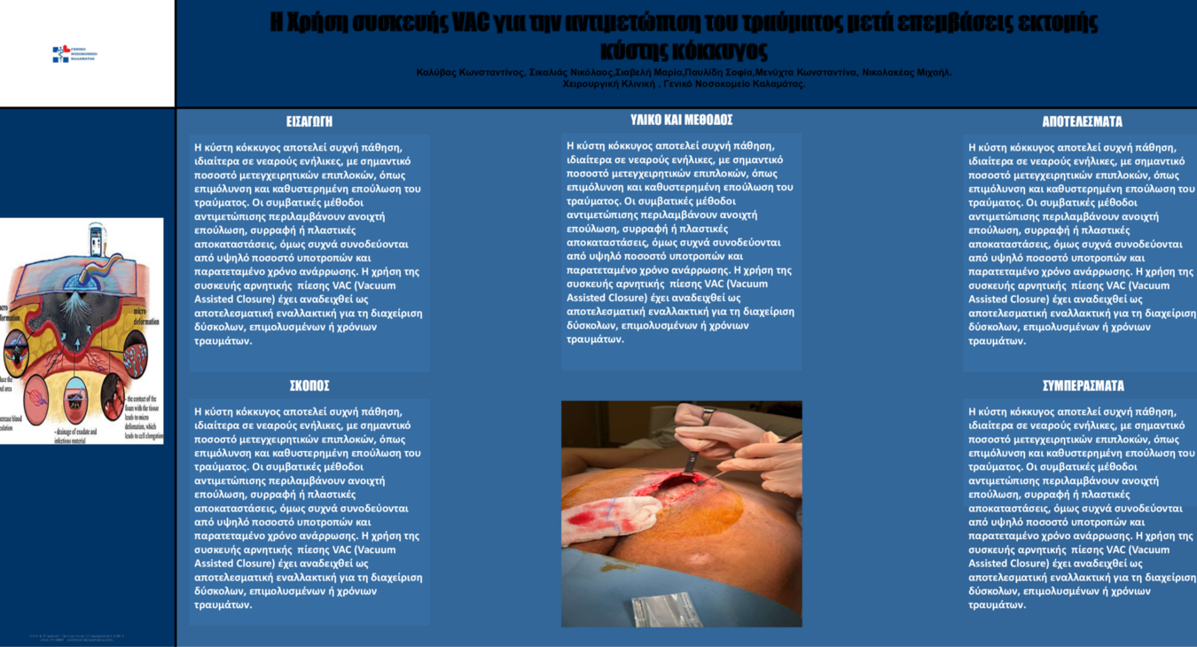 Η Χρήση συσκευής VAC για την αντιμετώπιση του τραύματος μετά επεμβάσεις εκτομής κύστης κόκκυγος