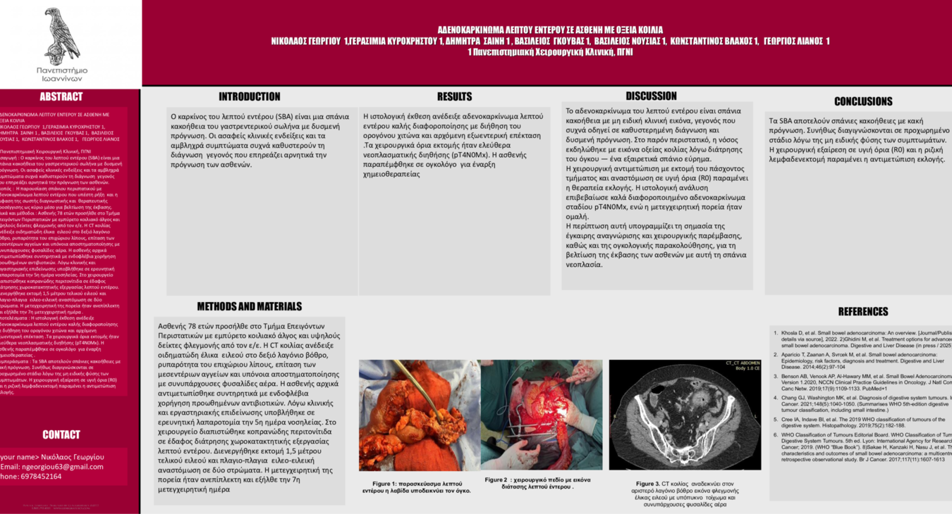 ΑΔΕΝΟΚΑΡΚΙΝΩΜΑ ΛΕΠΤΟΥ ΕΝΤΕΡΟΥ ΣΕ ΑΣΘΕΝΗ ΜΕ ΟΞΕΙΑ ΚΟΙΛΙΑ