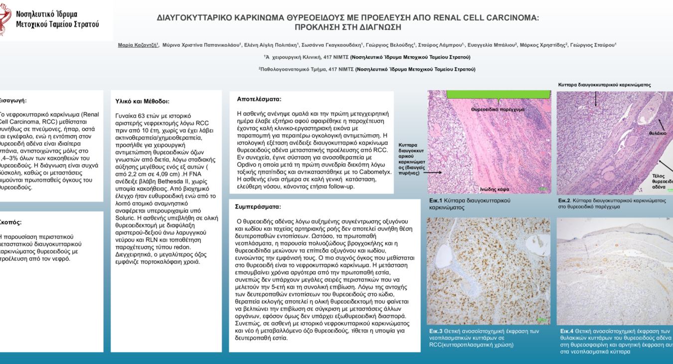 ΔΙΑΥΓΟΚΥΤΤΑΡΙΚΟ ΚΑΡΚΙΝΩΜΑ ΘΥΡΕΟΕΙΔΟΥΣ ΜΕ ΠΡΟΕΛΕΥΣΗ ΑΠΟ RENAL CELL CARCINOMA:  ΠΡΟΚΛΗΣΗ ΣΤΗ ΔΙΑΓΝΩΣΗ