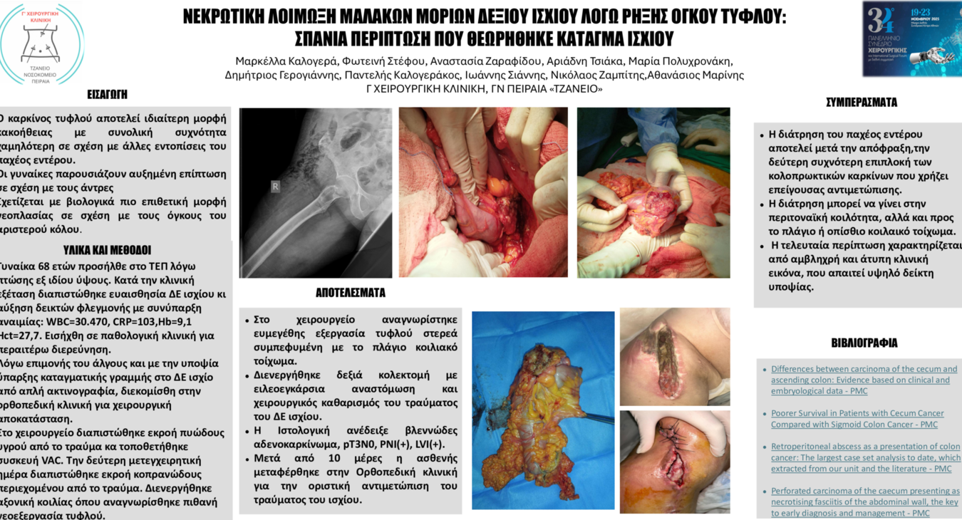 ΑΠΟΣΤΗΜΑ ΜΗΡΟΥ