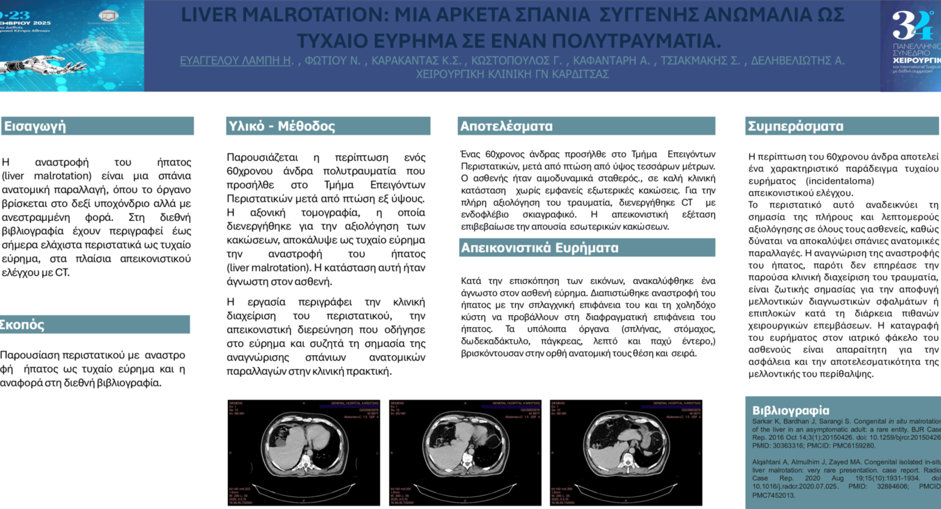 LIVER MALROTATION: ΜΙΑ ΑΡΚΕΤΑ ΣΠΑΝΙΑ ΣΥΓΓΕΝΗΣ ΑΝΩΜΑΛΙΑ ΩΣ ΤΥΧΑΙΟ ΕΥΡΗΜΑ ΣΕ ΕΝΑΝ ΠΟΛΥΤΡΑΥΜΑΤΙΑ.