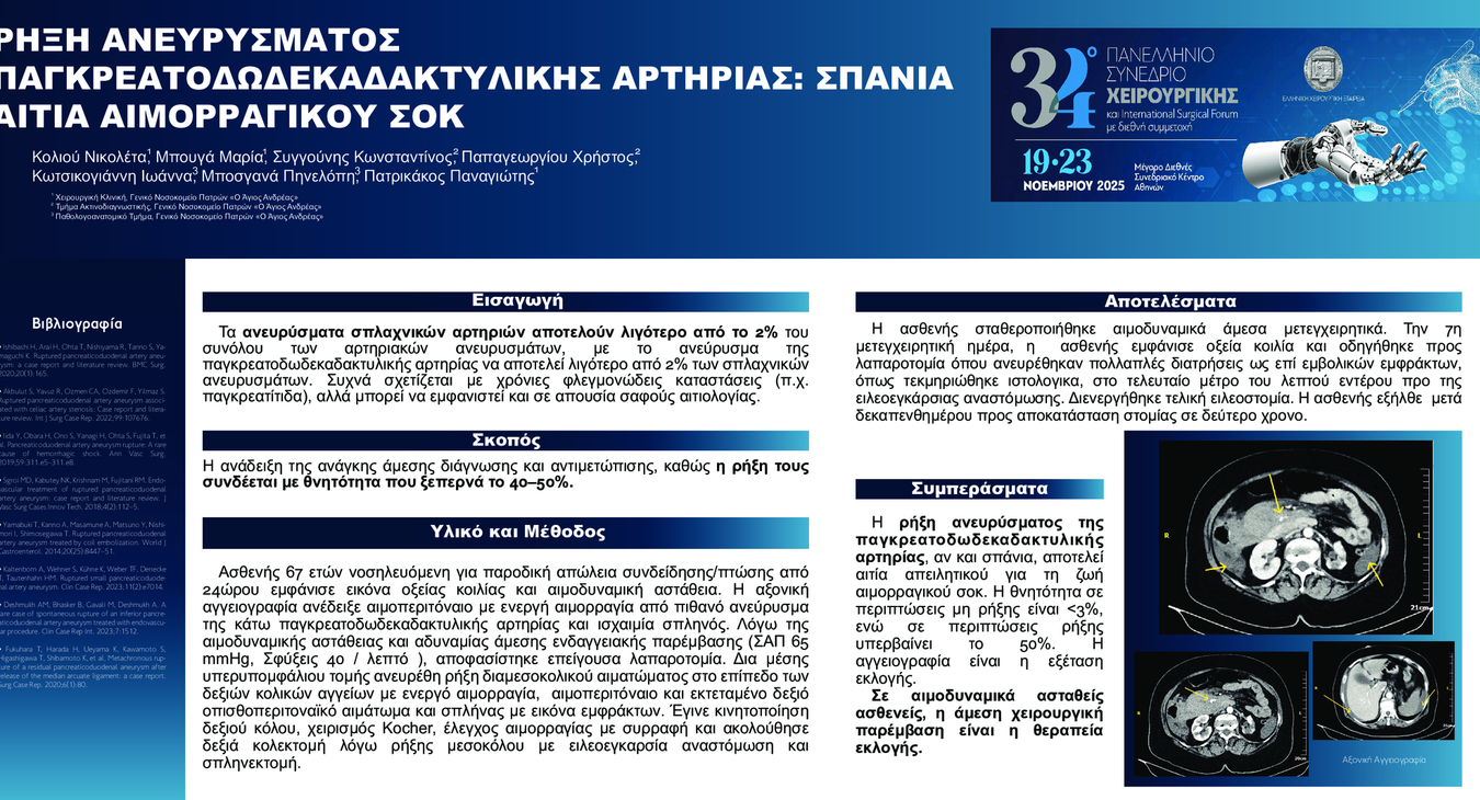 ΡΗΞΗ ΑΝΕΥΡΥΣΜΑΤΟΣ ΠΑΓΚΡΕΑΤΟΔΩΔΕΚΑΔΑΚΤΥΛΙΚΗΣ ΑΡΤΗΡΙΑΣ: ΣΠΑΝΙΑ ΑΙΤΙΑ ΑΙΜΟΡΡΑΓΙΚΟΥ ΣΟΚ