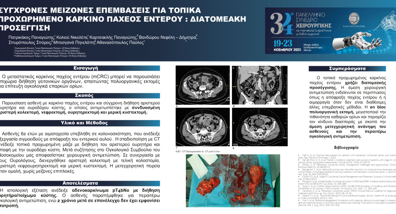 ΣΥΓΧΡΟΝΕΣ ΜΕΙΖΟΝΕΣ ΕΠΕΜΒΑΣΕΙΣ ΓΙΑ ΤΟΠΙΚΑ ΠΡΟΧΩΡΗΜΕΝΟ ΚΑΡΚΙΝΟ ΠΑΧΕΟΣ ΕΝΤΕΡΟΥ : ΔΙΑΤΟΜΕΑΚΗ ΠΡΟΣΕΓΓΙΣΗ