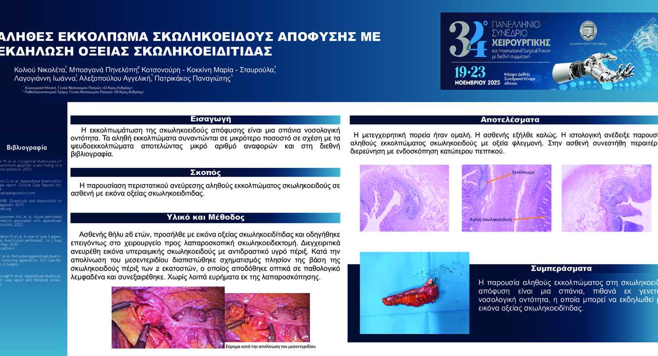 ΑΛΗΘΕΣ ΕΚΚΟΛΠΩΜΑ ΣΚΩΛΗΚΟΕΙΔΟΥΣ ΑΠΟΦΥΣΗΣ ΜΕ ΕΚΔΗΛΩΣΗ ΟΞΕΙΑΣ ΣΚΩΛΗΚΟΕΙΔΙΤΙΔΑΣ