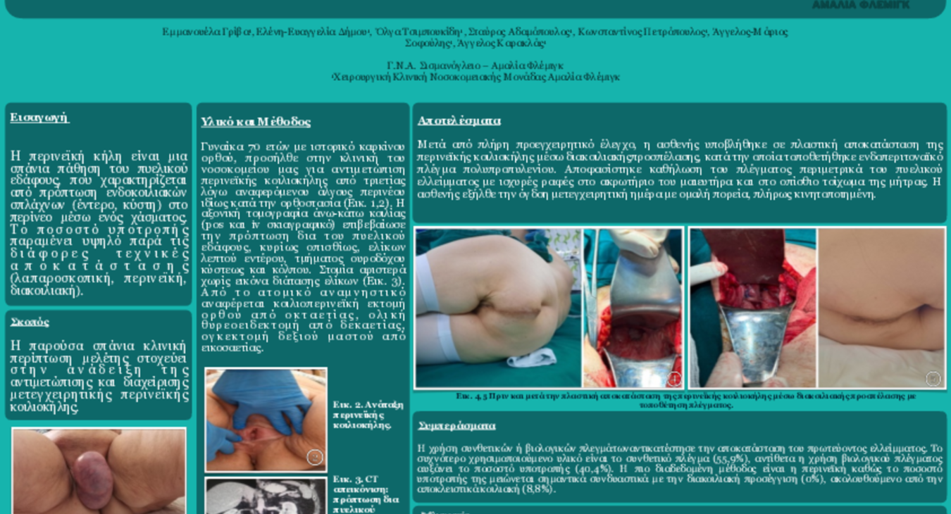 331 ΠΕΡΙΝΕΪΚΗ ΚΟΙΛΙΟΚΗΛΗ-ePoster