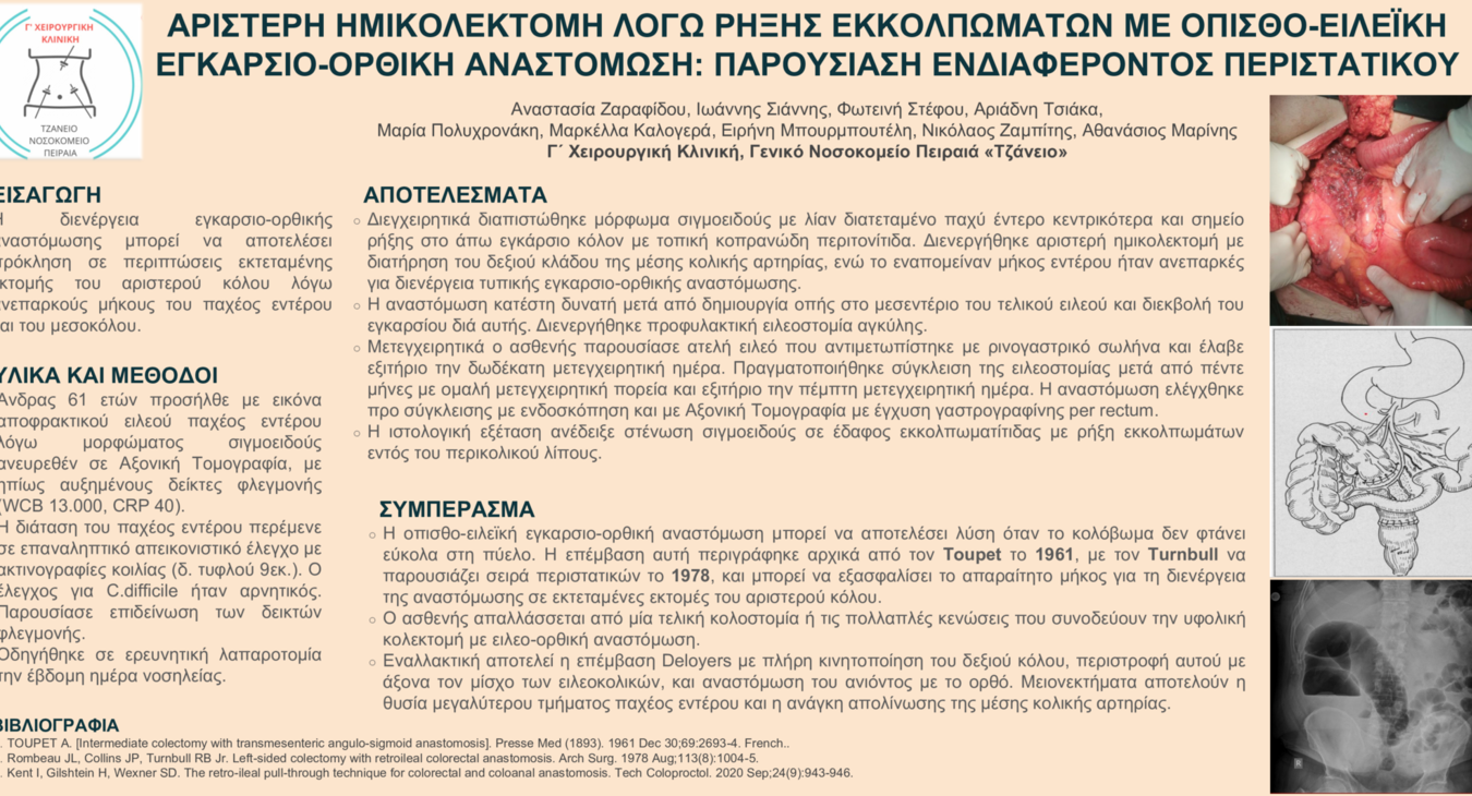 ΟΠΙΣΘΟ-ΕΙΛΕΪΚΗ ΕΓΚΑΡΣΙΟ-ΟΡΘΙΚΗ ΑΝΑΣΤΟΜΩΣΗ