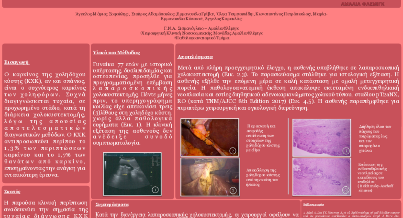 327 ΤΥΧΑΙΟ ΕΥΡΗΜΑ ΚΑΡΚΙΝΟΥ ΧΟΛΗΔΟΧΟΥ ΚΥΣΤΗΣ ΜΕΤΑ ΑΠΟ ΛΑΠΑΡΟΣΚΟΠΙΚΗ ΧΟΛΟΚΥΣΤΕΚΤΟΜΗ-ePoster