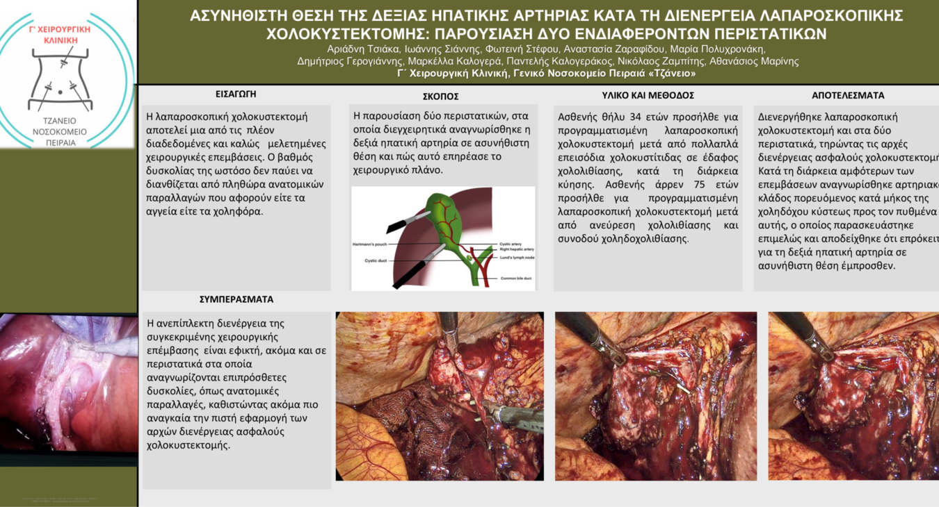 ΠΑΡΑΛΛΑΓΕΣ ΔΕΞΙΑΣ ΗΠΑΤΙΚΗΣ