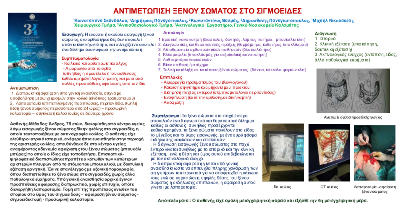 Ξένο σώμα στο ορθοσιγμοειδές