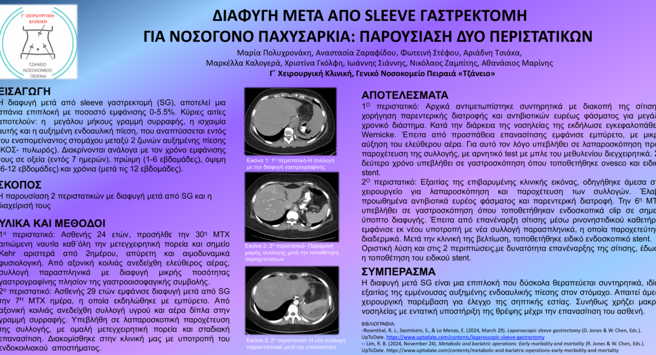 ΔΙΑΦΥΓΗ ΑΠΟ SLEEVE