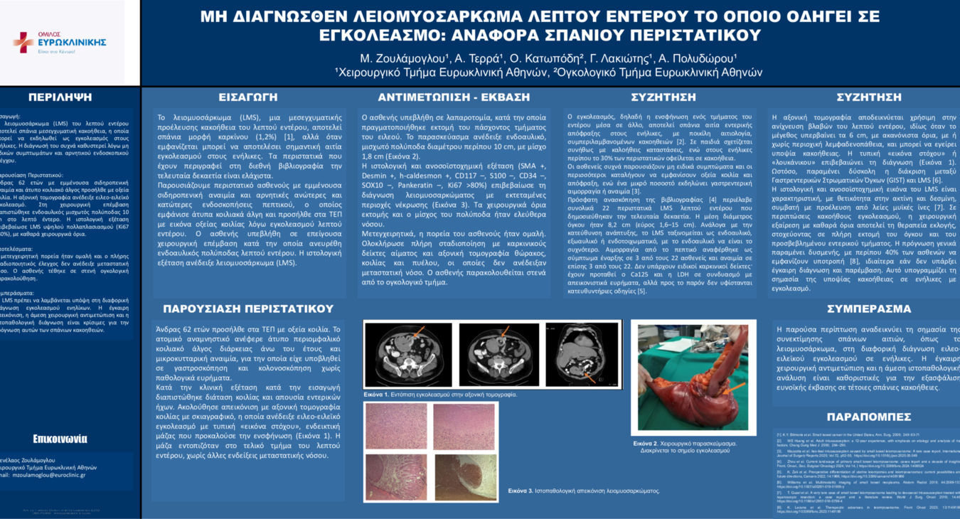 ΜΗ ΔΙΑΓΝΩΣΘΕΝ ΛΕΙΟΜΥΟΣΑΡΚΩΜΑ ΛΕΠΤΟΥ ΕΝΤΕΡΟΥ ΤΟ ΟΠΟΙΟ ΟΔΗΓΕΙ ΣΕ ΕΓΚΟΛΕΑΣΜΟ: ΑΝΑΦΟΡΑ ΣΠΑΝΙΟΥ ΠΕΡΙΣΤΑΤΙΚΟΥ