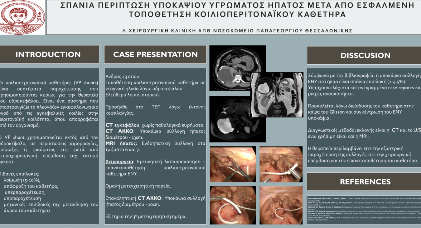 Σπάνια περίπτωση υποκάψιου υγρώματος ήπατος μετά απο εσφαλμένη τοποθέτηση κοιλιοπεριτοναϊκού καθετήρα