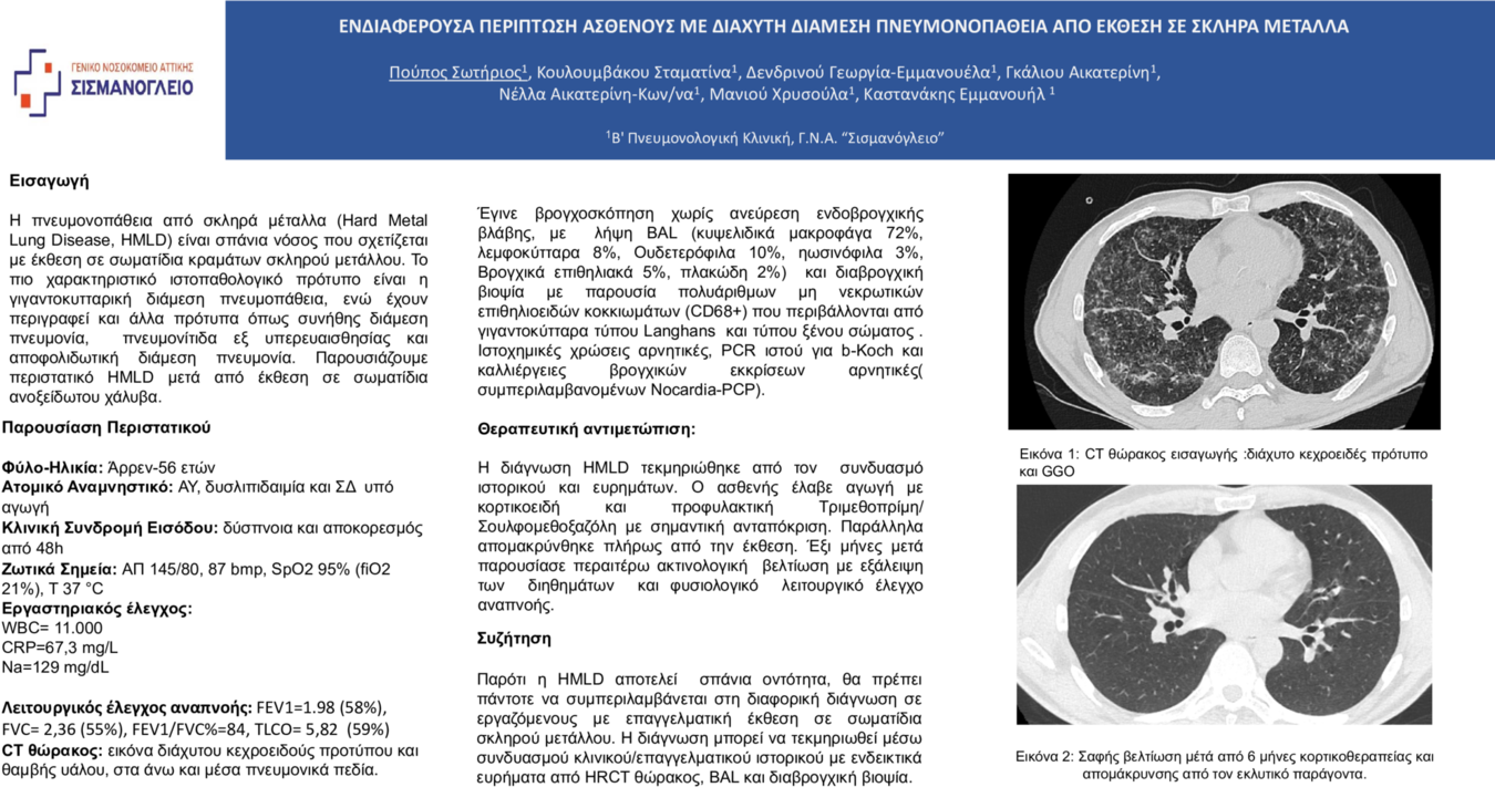 Hard Metal Lung Disease