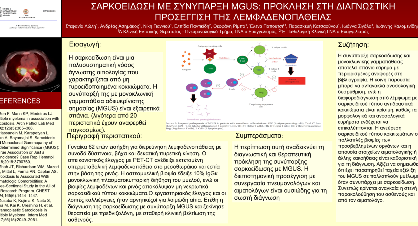 ΣΑΡΚΟΕΙΔΩΣΗ ΜΕ ΣΥΝΥΠΑΡΞΗ MGUS: ΠΡΟΚΛΗΣΗ ΣΤΗ ΔΙΑΓΝΩΣΤΙΚΗ ΠΡΟΣΕΓΓΙΣΗ ΤΗΣ ΛΕΜΦΑΔΕΝΟΠΑΘΕΙΑΣ