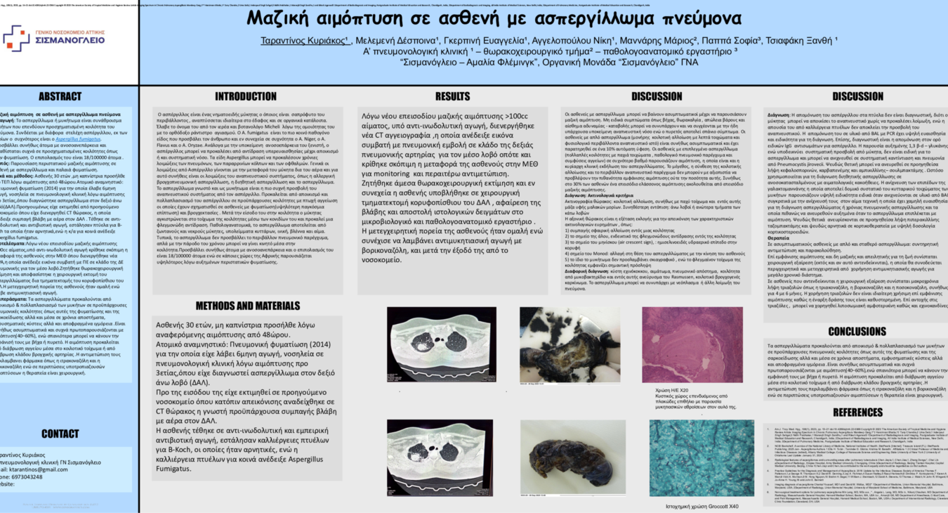 Μαζική αιμόπτυση σε ασθενή με ασπεργίλλωμα πνεύμονα