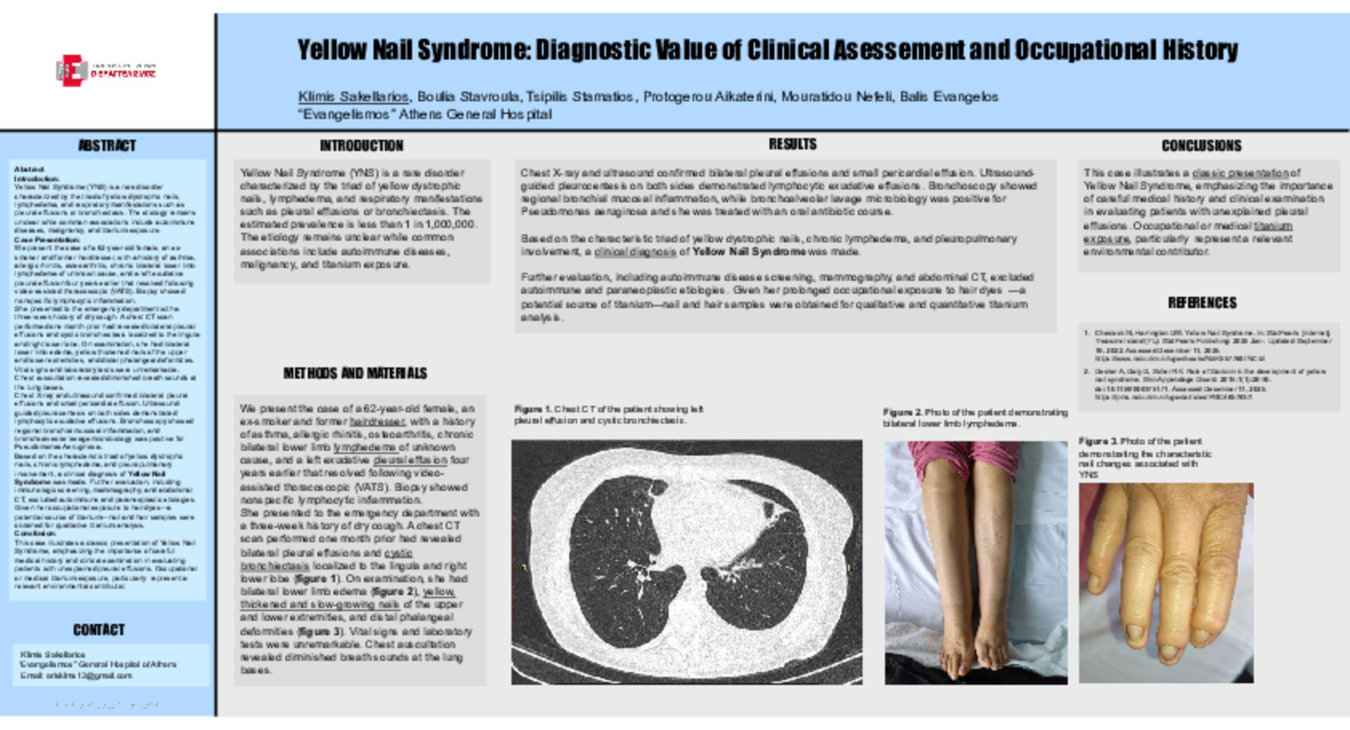 “Yellow Nail Syndrome: Diagnostic Value of Clinical Assessment and Occupational History”