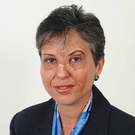 Dr. med. Καλλιόπη Αγγ. Αθανασιάδη, MD, PhD, FEBTS, Χειρουργός Θώρακος, Δ/ντρια ΕΣΥ